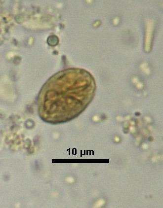 Microscopic Diagosis Cyst