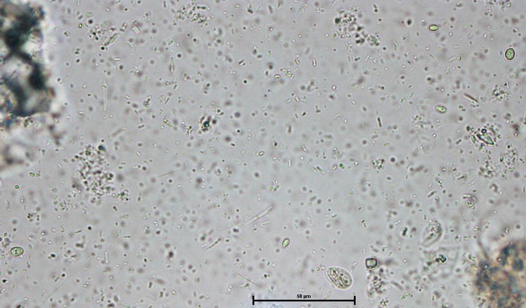 Microscopic Diagosis 40x
