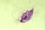 Diagosis of Giardia what to look for T.