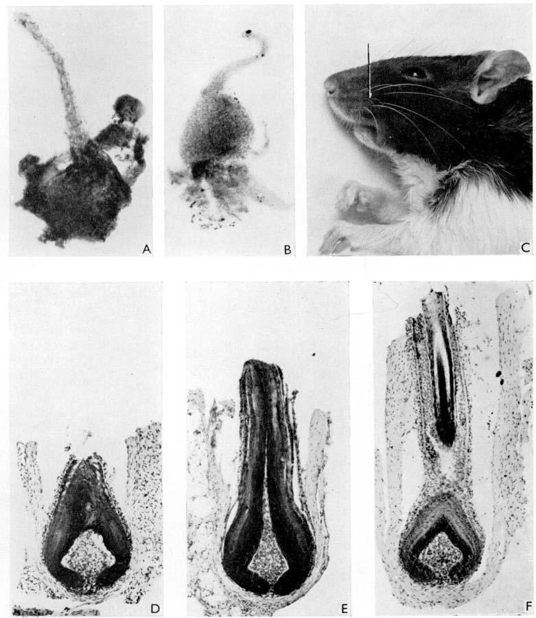Mayer's haemalum. Fig. A, x 85; fig. B, x75. Fig. C. Rat II, 15 weeks after removal of root ends from follicles 46-4/on the left lip.