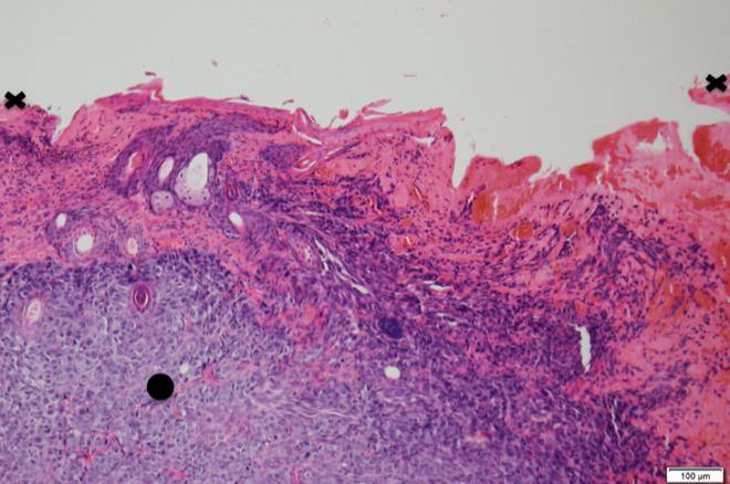 Figure 3a - Photo of mouse with tumour depicted in Figures 3b3c Figure 3b: Black arrow shows normal epidermis.