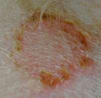 pyoderma therapy? underlying dz?