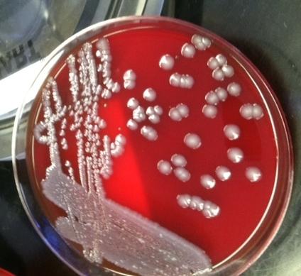 OUR LTCF ISSUES WITH TREATMENT OF INFECTIONS Frequent colonization with multi-drug resistant organisms that can result in infection Incomplete reporting of patient s symptoms
