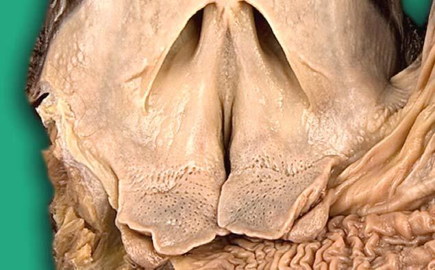 The choana (C) flanked by two small folds laterally (black arrows) and small raised nodules rostrally (blue arrows) is situated in the caudal
