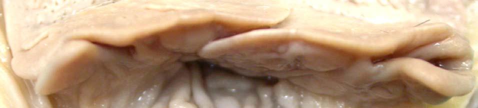 Note the medial overlapping of the free caudal aspect of the pharyngeal folds in the inset.