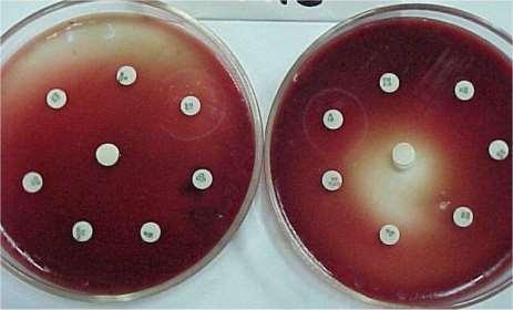 Microbiological Effects: Development of multi-resistant microorganisms Observed association between use of antibiotics in production
