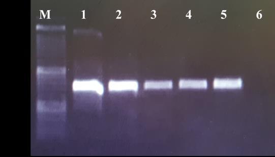 B8/1 Genetic Variability among Echinococcus granulosus extension at 72 ºC for 40 sec, and a final extension at 72 ºC for 4 min. The PCR product was electrophoresed in a 1.