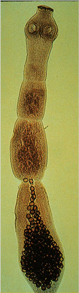 Taxonomy Class Cestode Order Cyclophyllidea Family Taeniidae Genus Echinococcus Species Echinococcus multilocularis Others species: E.