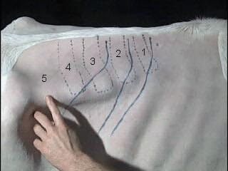 Figure 1 Spinal Nerves T13, L1 and L2 Technique Hair is clipped to include the local anesthetic block sites and surgical site; cranial to caudal margins are from the dorsal margin of the 11th rib to
