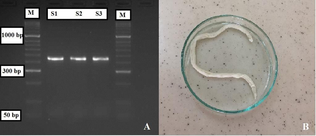 Figure 1. A- Specific PCR amplification of cox1 of Toxocara vitulorum gene on 1.5% agarose gel. Lane M represents the 50 bp DNA ladder. B- Macroscopic appearance of adult T. vitulorum. Neighbor-Joining (NJ) method.