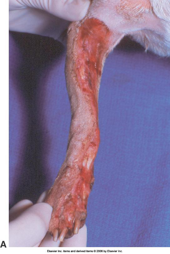 Degloving incident After surgical debridement and open wound management, the wound healed by second intention with contraction and epithelialization.