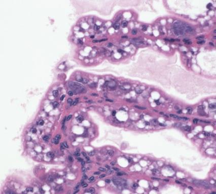H&E histology and in situ hybridization of EHP in