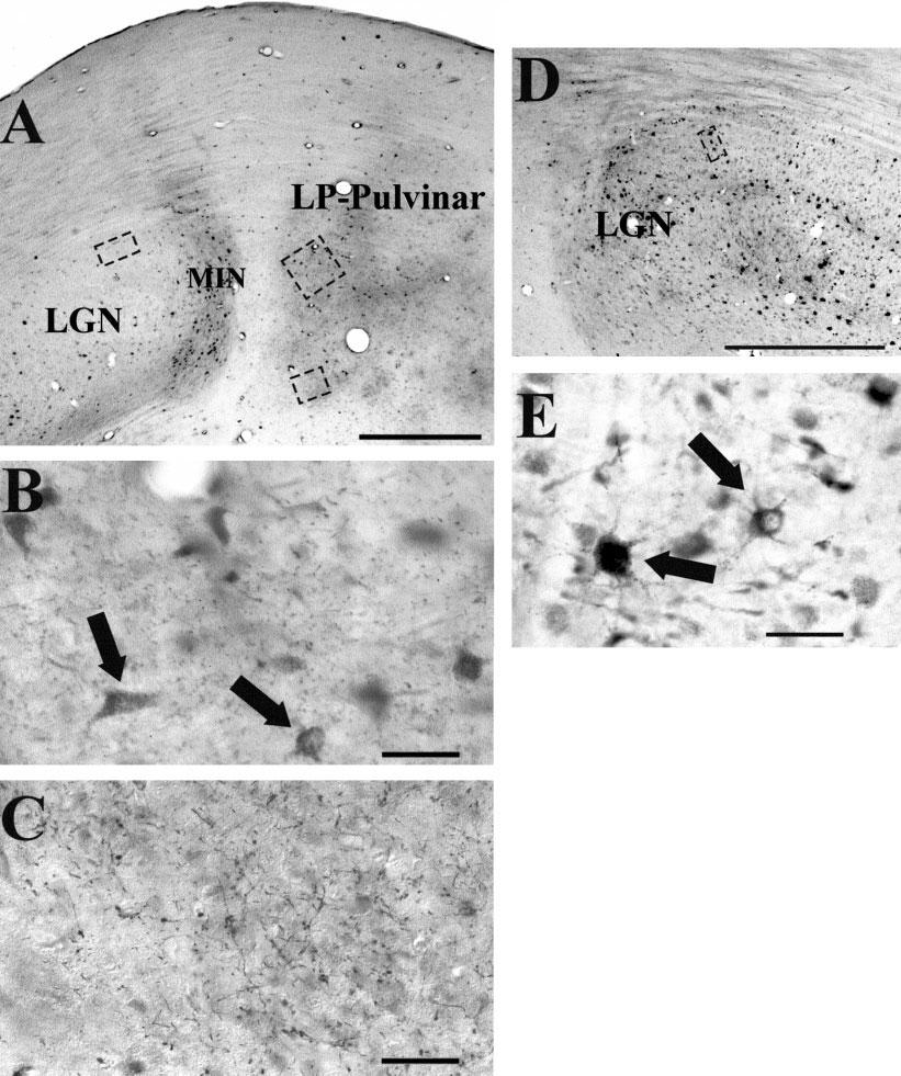 CORTICOTHALAMIC PROJECTION PATTERNS 409 Fig. 2. Areas of interest sampled viewed with the light microscope. A: Low-power image showing transport of biotinylated dextran amine label.