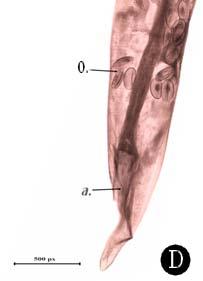 anterior end ; (D)female, posterior end;