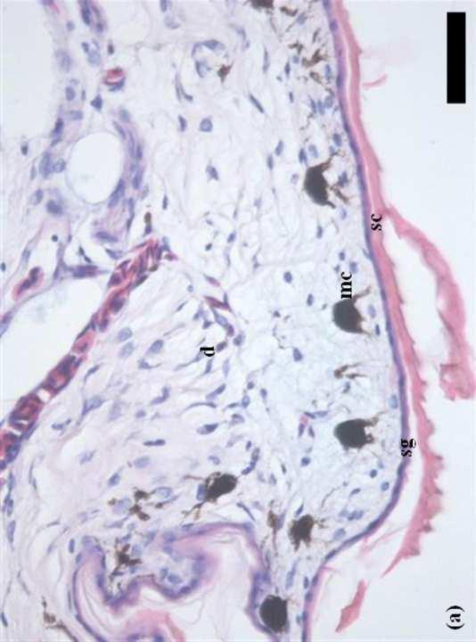 Histological image normal skin (Fig