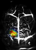 Ma, Konstantin Maslov, LV Wang, unpublished Photoacoustic Computed Tomography of the Whole Brain of a Mouse