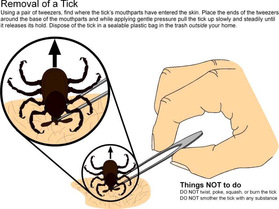 If Bitten by a Tick Tick removal Grasp the base of the tick s mouthparts