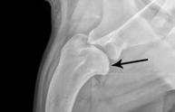 OSTEOCHONDROSIS (OCD) OF THE SHOULDER W hile the exact mode of inheritance is unknown, osteochondrosis is considered to be an inherited disease.