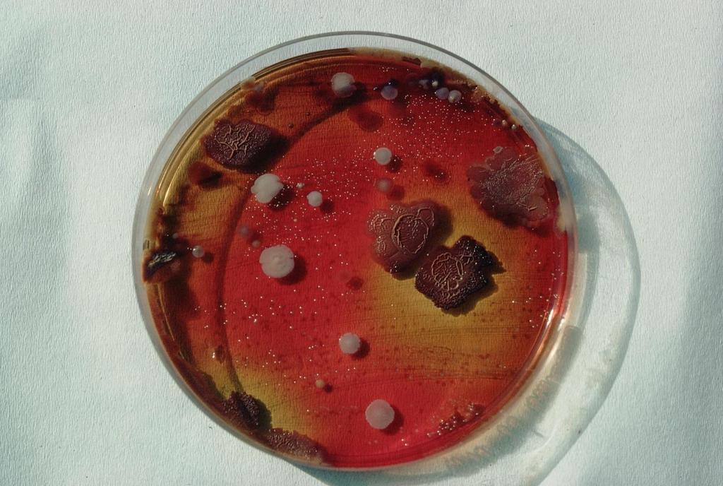 Brucella on Blood Agar Selective media almost always needed