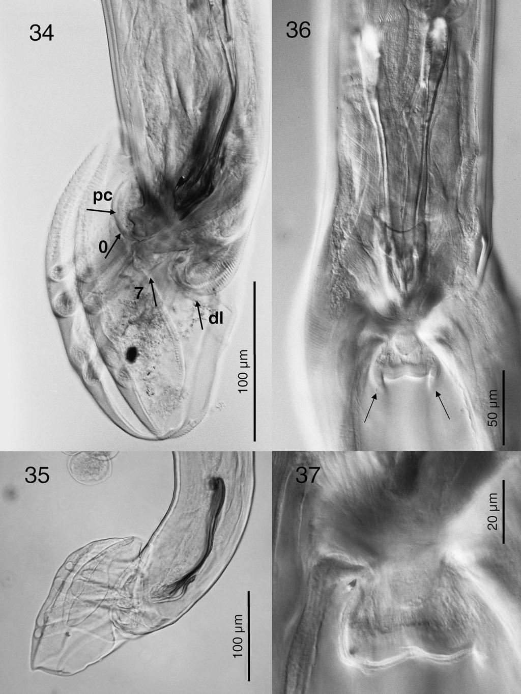 242 THE JOURNAL OF PARASITOLOGY, VOL. 94, NO. 1, FEBRUARY 2008 FIGURES 34 37. Africanastrongylus buceros gen. nov. et sp. nov., showing male bursal attributes based on photomicrographs of paratypes.