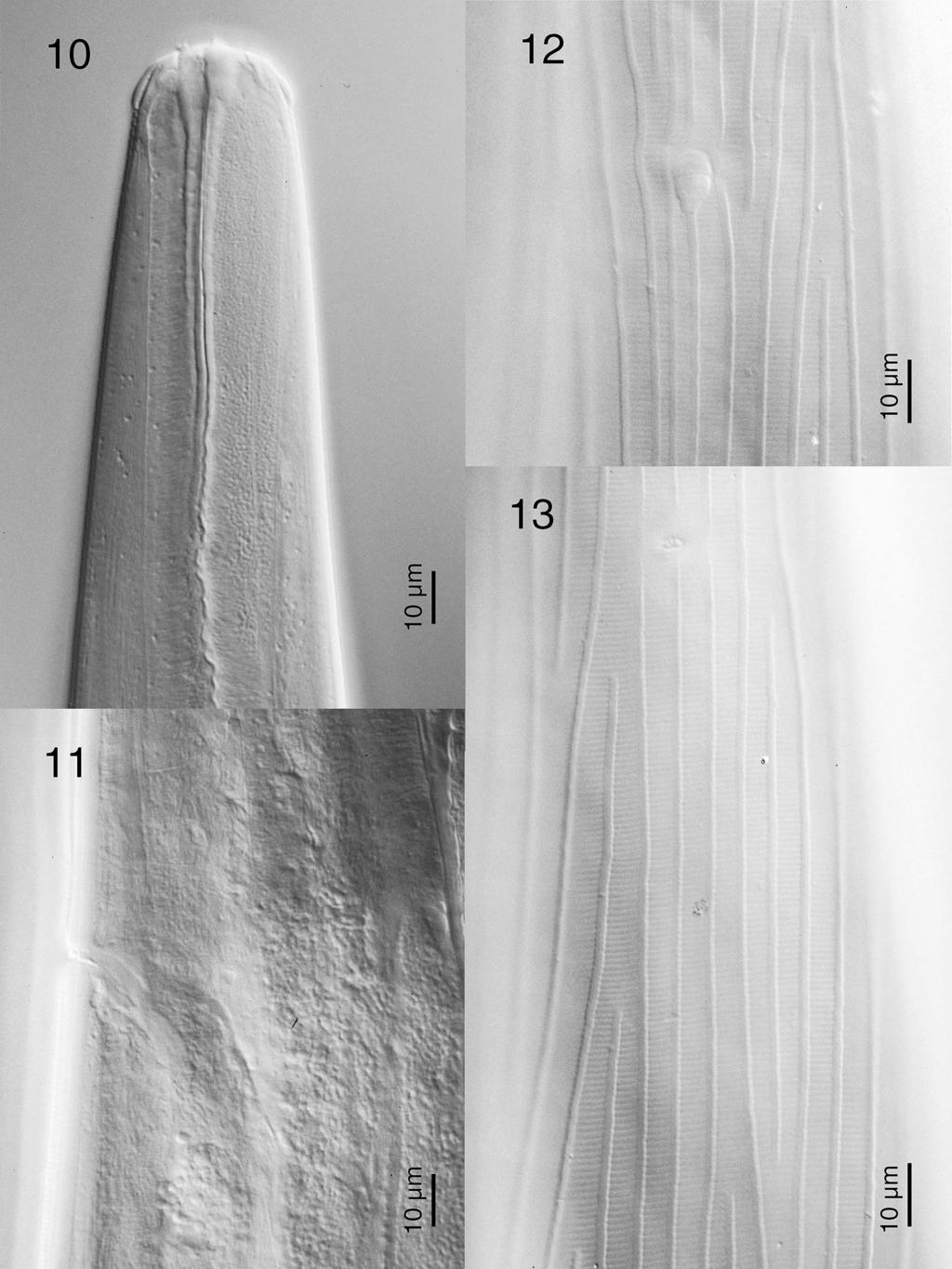 HOBERG ET AL. AFRICAN OSTERTAGIINAE 235 FIGURES 10 13. Africanastrongylus buceros gen. nov. et sp. nov., cervical and cephalic attributes based on photomicrographs in a female paratype (USNPC 99551).