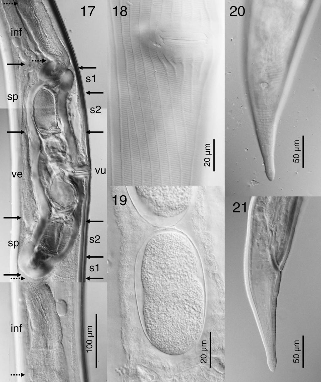 HOBERG ET AL. AFRICAN OSTERTAGIINAE 237 FIGURES 17 21. Africanastrongylus buceros gen. nov. et sp. nov., showing structural characters of females based on photomicrographs.