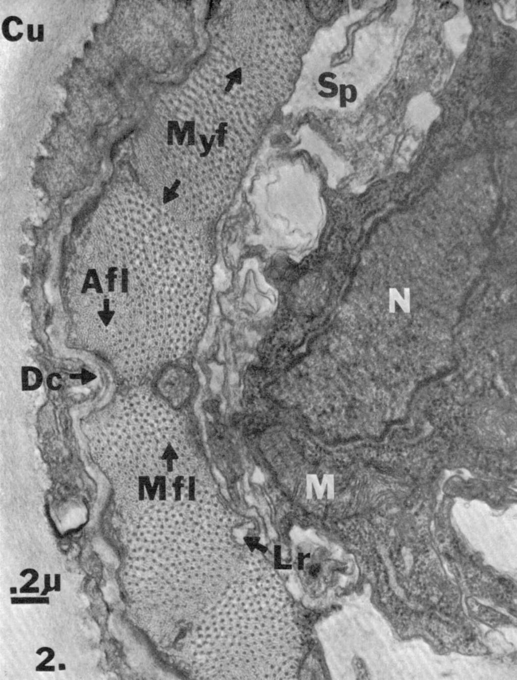 Transverse section of posterior dorsal somatic muscle cell of Trichodorus porosus: