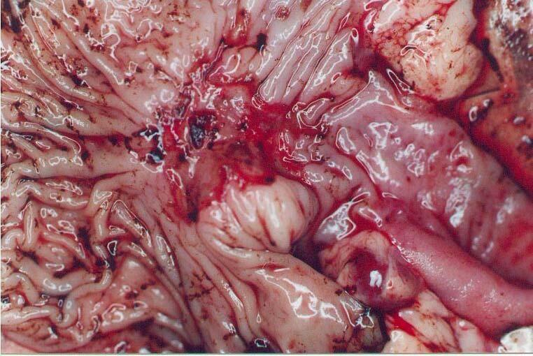 biopsy impression smears Lymphofollicular