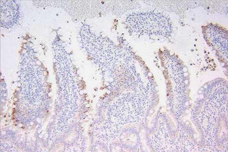 Lesions Vacuolar degeneration and necrosis of villar tip enterocytes