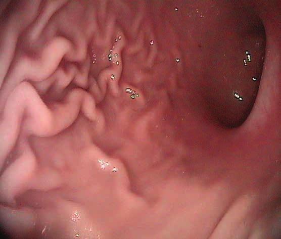 Endoscopic images courtesy of Dr.