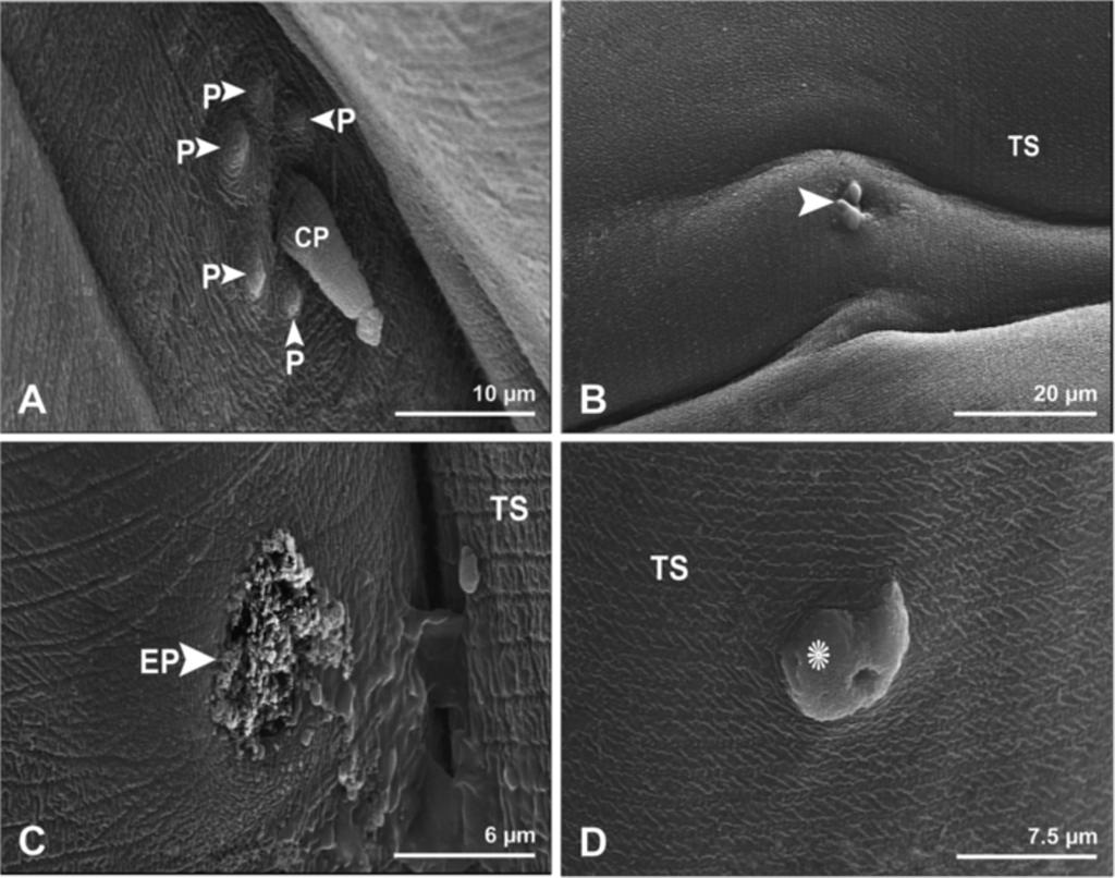 Gorgani et al. Parasites & Vectors 2013, 6:87 Page 4 of 8 Figure 2 Scanning electron micrographs showing anterior end of female Physaloptera clausa.
