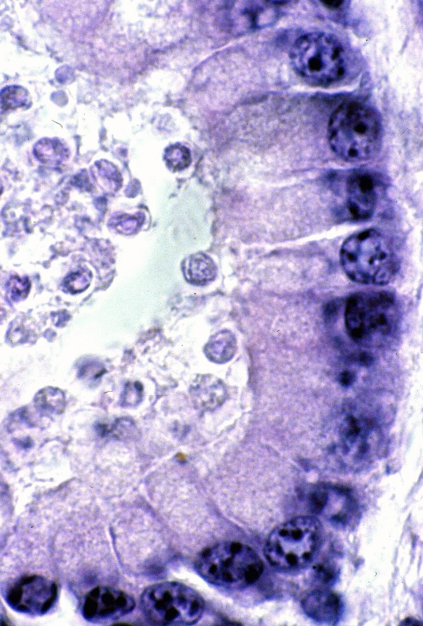 Pathogenesis Abomasal cryptosporidiosis C.