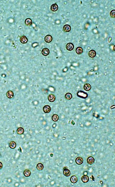 Diagnosis Fecal exam Sugar-centrifugal fecal flotation C. parvum oocysts Round & very small 4-6 µm C.