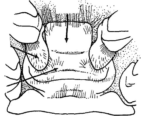 89 Metapenaeopsis stridulans (Alcock, 1905) (Fiddler Shrimp) Diagnostic features: rostrum straight; 5-7 strong stridulating ridges in a wide straight band on the posterior part of carapace;