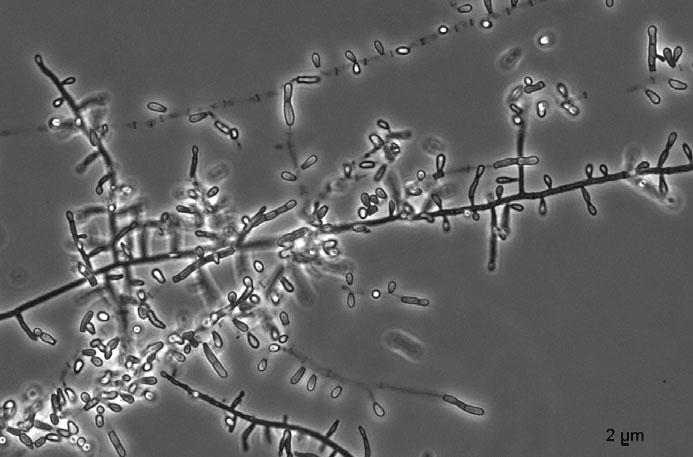 Figure 5. Microscopic morphology of case 5 isolate showing conidia borne on the sides of the hyphae. intralesional hyphae, culture and ITS sequencing of the fungus in one case.