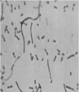 Bacterial Pathogens Associated with ABRS Haemophilus influenzae Gm negative rod-shaped bacterium ~30% beta-lactamase production rate nationwide Non-typable strains cause ABRS Adults=36% Children=31