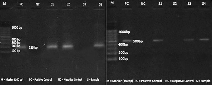 3 of the primer mix, 2 μl of dntp mix (5 mm each), 3 μl of 25 mm MgCl 2, 1 unit of Taq DNA polymerase (Fermatas), 5μl of sample DNA in a total volume of 50 μl.