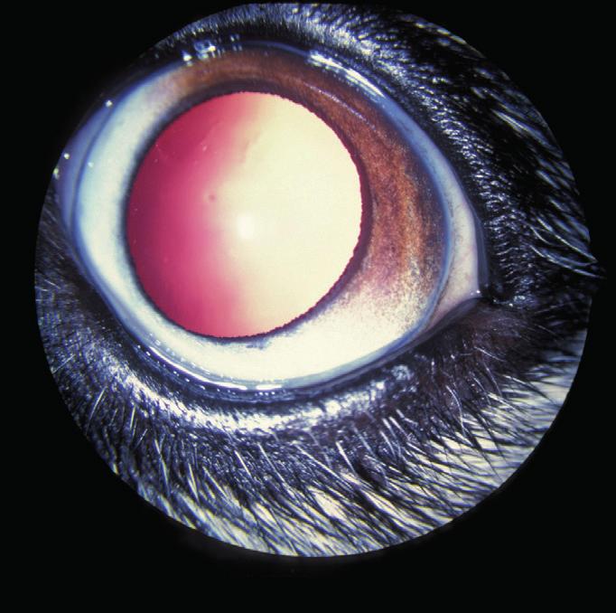 Picture, Sue Jones The normal eye 1 1: Normal adult eye of
