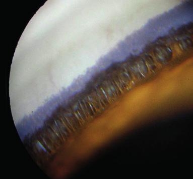 9 10 11 12 13 14 15 16 17 9: Anterior segment gross globe the iris root processes that comprise the pectinate ligament span the entrance to the ciliary cleft.