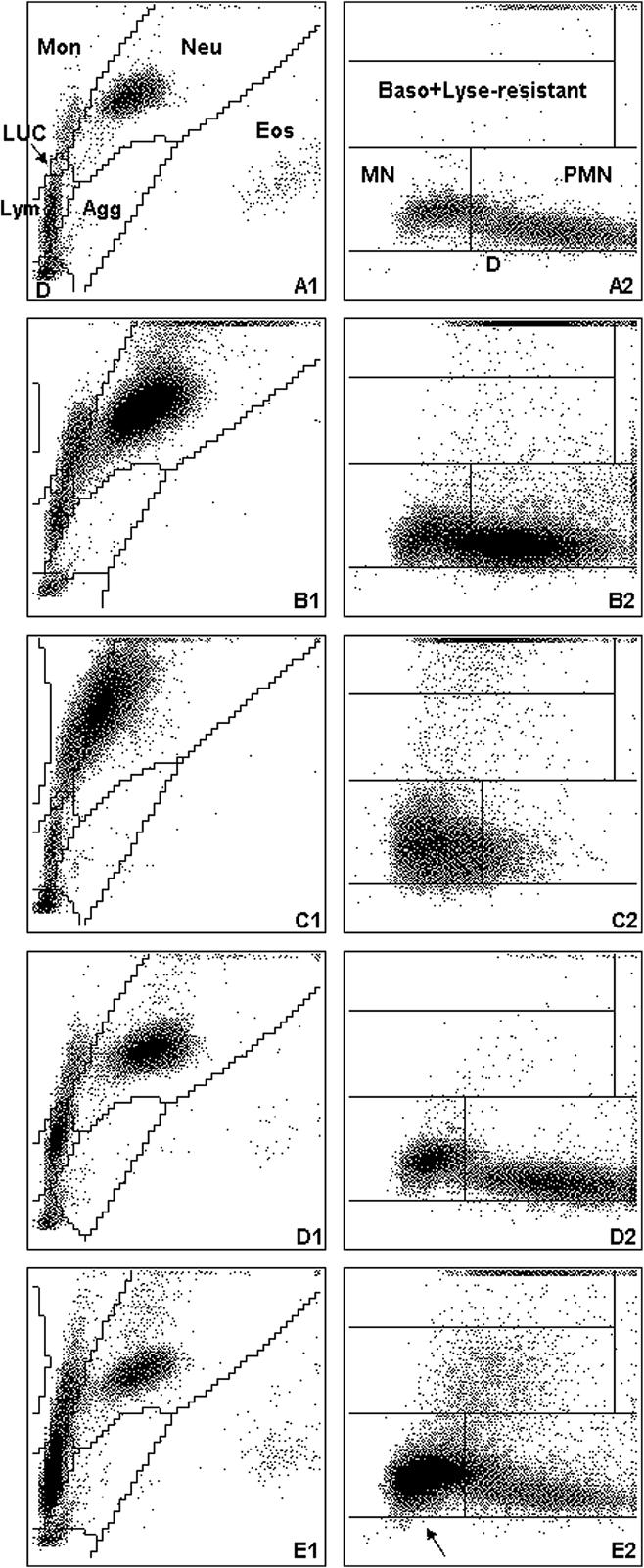 Stirn et al. BMC Veterinary Research 2014, 10:125 Page 5 of 8 Figure 3 Cytograms of the ADVIA 120 for horse samples. For remainder of key see Figure 1. (A) Cytograms without any abnormalities.