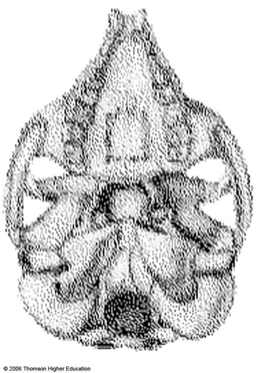 a Hole at back of skull; the backbone is
