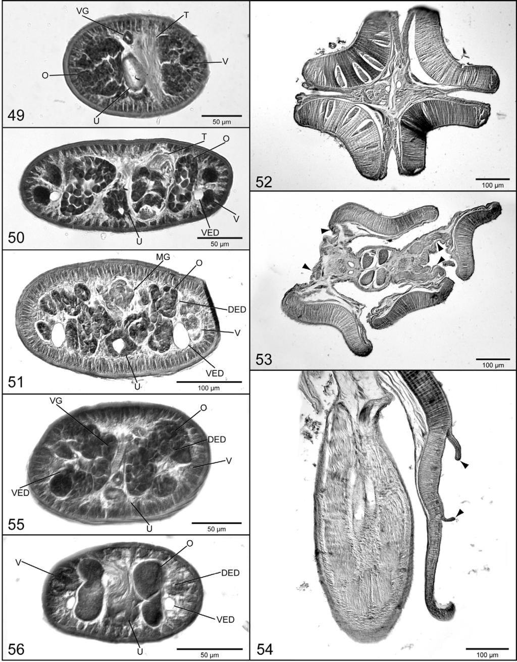 Figs. 49 56. Histological sections. Fig. 49. Cross-section through ovary of Acanthobothrium oceanharvestae sp. n. (QM G231349). Fig. 50. Cross-section through ovary of Acanthobothrium popi sp. n. (QM G231353).