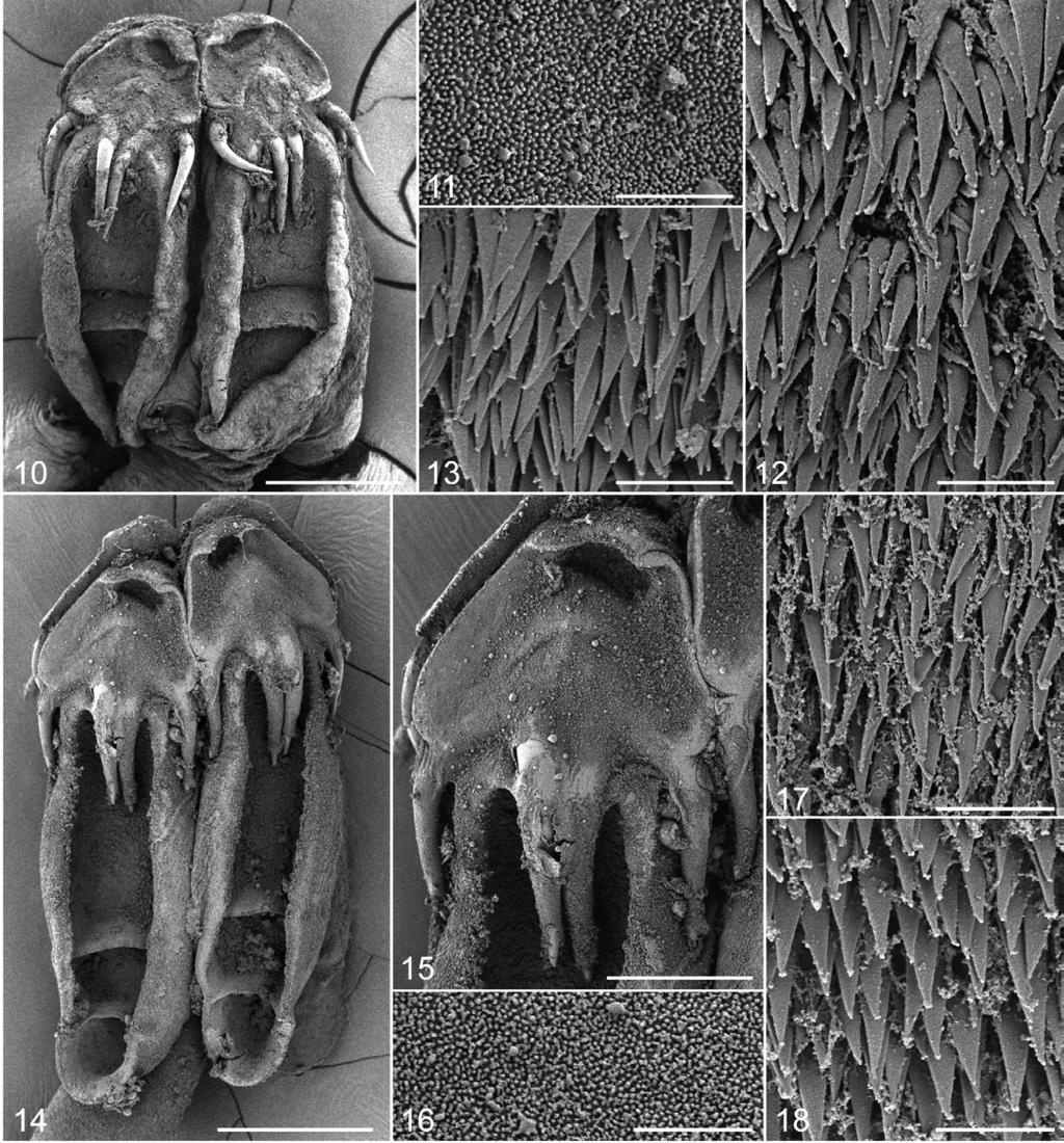 Fyler et al.: Five new species of Acanthobothrium 11 12 13 16 17 18 Figs. 10 13. Scanning electron micrographs of Acanthobothrium oceanharvestae sp. n. Fig. 10. Scolex.