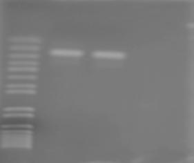 Sultana et al. 17 1 2 3 4 241 Fig. 1. Identification of Staphylococcus spp. by amplification of 16S rrna gene by PCR.