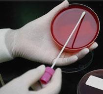 Antibiotic sensitivity testing isolation,