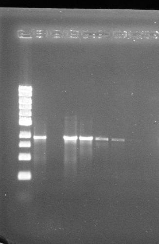 Figure 10. Agarose gel electrophoresis of the PCR amplification products of 16M DNA serially diluted in sterile H 2 O using the ORF-944 region E primers.