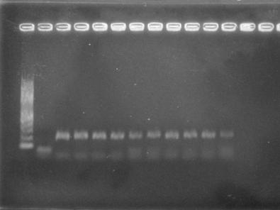 dilutions of 16M and 2308 CFU in plasma using the Baily and Omp25