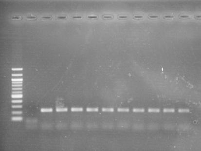 DNA isolation concentrations from 10 7 CFU/μl 1 CFU/10μl The order of