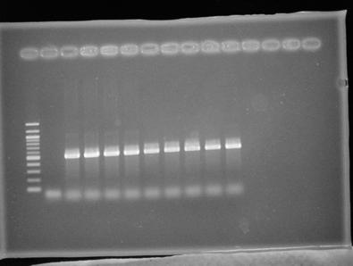 isolated from dilutions of 16M and 2308 CFU in urine using
