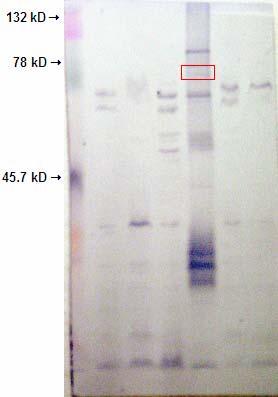 1 2 3 4 5 6 7 Figure 7. Western Blot run with absorbed serum from a goat inoculated with RB51-QAE. The serum was absorbed using RB51 previously.